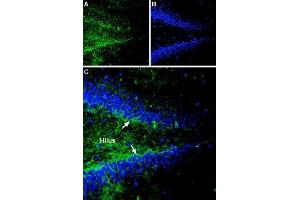 Expression of Gephyrin in rat hippocampus - Immunohistochemical staining of rat hippocampal dentate gyrus sections using Anti-Gephyrin Antibody (ABIN7043214, ABIN7044520 and ABIN7044521).