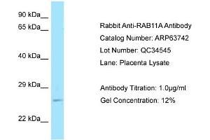 Image no. 1 for anti-RAB11A, Member RAS Oncogene Family (RAB11A) (C-Term) antibody (ABIN2789607)