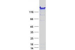 Image no. 1 for Nuclear Autoantigenic Sperm Protein (Histone-Binding) (NASP) (Transcript Variant 2) protein (Myc-DYKDDDDK Tag) (ABIN2726842)