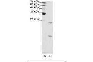 Image no. 2 for anti-Small Nuclear Ribonucleoprotein Polypeptide F (SNRPF) (N-Term) antibody (ABIN202012)