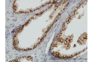 Image no. 2 for anti-Forkhead Box A1 (FOXA1) (AA 367-472) antibody (ABIN516563)
