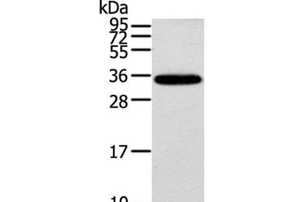 KCNMB3 Antikörper