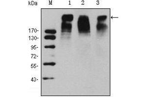 Image no. 2 for anti-MKI67 FHA Domain-Interacting Nucleolar Phosphoprotein (MKI67IP) antibody (ABIN1499027)
