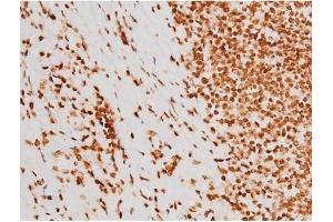 Image no. 3 for anti-REL proto-oncogene (c-Rel) (pSer503) antibody (ABIN6255382)