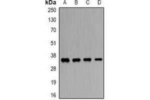 Image no. 2 for anti-Origin Recognition Complex, Subunit 6 (ORC6) antibody (ABIN3197748)
