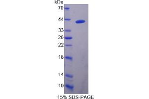 Image no. 1 for DnaJ (Hsp40) Homolog, Subfamily B, Member 1 (DNAJB1) (AA 2-340) protein (T7 tag,His tag) (ABIN6239979)