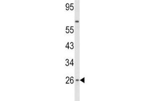 Image no. 4 for anti-Interferon, beta 1, Fibroblast (IFNB1) (AA 39-66) antibody (ABIN3028749)