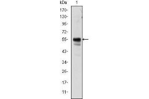 Image no. 3 for anti-Runt-Related Transcription Factor 1 (RUNX1) antibody (ABIN969389)