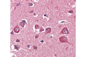 IHC analysis of FFPE human brain cortex tissue stained with PINK1 antibody