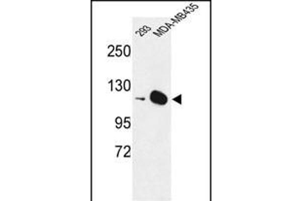 DIAPH2 Antikörper  (AA 870-899)