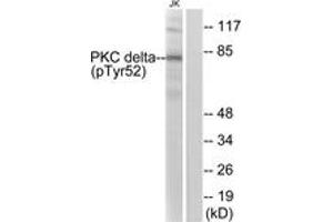 Western blot analysis of extracts from Jurkat cells treated with starved 24h, using PKC delta (Phospho-Tyr52) Antibody.