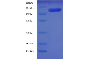 Image no. 1 for Src Kinase Associated phosphoprotein 1 (SKAP1) (AA 1-358) protein (His-SUMO Tag) (ABIN5711475)