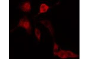 Image no. 2 for anti-Interferon Induced with Helicase C Domain 1 (IFIH1) antibody (ABIN6262453)