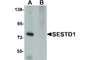 SESTD1 抗体  (C-Term)