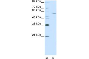 Image no. 1 for anti-REST Corepressor 1 (RCOR1) antibody (ABIN2461866)