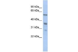 Image no. 1 for anti-Solute Carrier Family 38, Member 2 (SLC38A2) (N-Term) antibody (ABIN2777727)