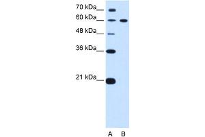Image no. 1 for anti-Deltex Homolog 2 (DTX2) (C-Term) antibody (ABIN2774772)