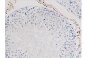 alpha Adducin anticorps  (pSer726)