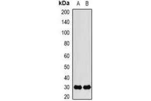 Image no. 2 for anti-FK506 Binding Protein 3, 25kDa (FKBP3) antibody (ABIN3198069)