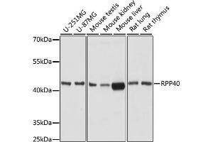 RPP40 抗体  (AA 130-210)