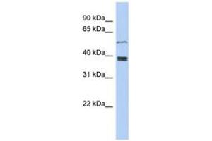 Image no. 1 for anti-Synovial Sarcoma Translocation Gene On Chromosome 18-Like 1 (SS18L1) (AA 251-300) antibody (ABIN6743926)