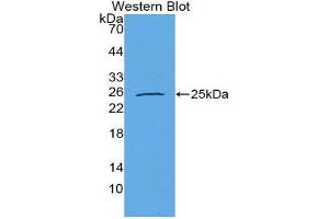 Image no. 1 for anti-Prolactin-Induced Protein (PIP) (AA 1-146) antibody (ABIN1869810)
