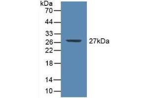 CRP anticorps  (AA 17-224)