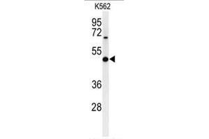 Image no. 1 for anti-beta-1,3-Glucuronyltransferase 1 (Glucuronosyltransferase P) (B3GAT1) (AA 27-57), (N-Term) antibody (ABIN951358)