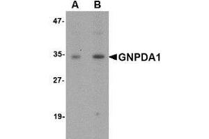 Image no. 2 for anti-Glucosamine-6-Phosphate Deaminase 1 (GNPDA1) (C-Term) antibody (ABIN499896)