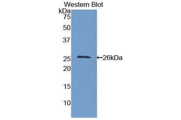 ICAM4 antibody  (AA 32-226)