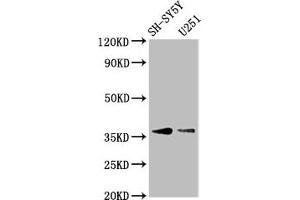 BARHL1 antibody  (AA 38-176)