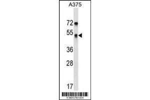Image no. 1 for anti-Septin 11 (SEPT11) (AA 353-382) antibody (ABIN1538350)