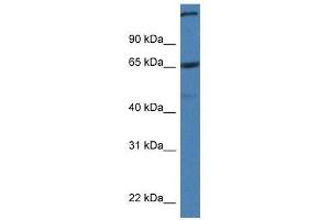 Image no. 1 for anti-ST6 (Alpha-N-Acetyl-Neuraminyl-2,3-beta-Galactosyl-1,3)-N-Acetylgalactosaminide alpha-2,6-Sialyltransferase 1 (ST6GALNAC1) (C-Term) antibody (ABIN928143)