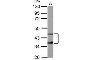 Image no. 1 for anti-Transcription Factor Dp-2 (E2F Dimerization Partner 2) (TFDP2) (Internal Region) antibody (ABIN2855370)