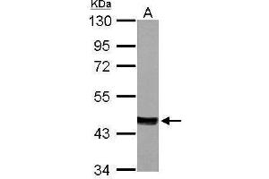 Image no. 4 for anti-Mevalonate (Diphospho) Decarboxylase (MVD) (Center) antibody (ABIN2856802)