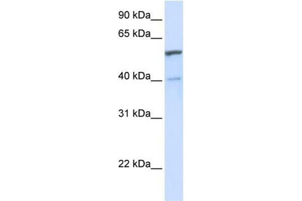 anti-UDP Glucuronosyltransferase 1 Family, Polypeptide A6 (UGT1A6) (C-Term) antibody