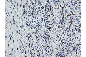 Image no. 2 for anti-Coagulation Factor XIII, A1 Polypeptide (F13A1) antibody (ABIN1498146)