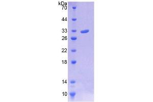 Image no. 1 for Chromosome 10 Open Reading Frame 2 (C10ORF2) (AA 384-635) protein (His tag) (ABIN6239978)