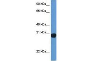 Image no. 1 for anti-Synaptosomal-Associated Protein, 29kDa (SNAP29) (AA 110-159) antibody (ABIN6747257)