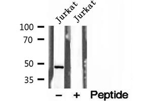 Image no. 2 for anti-Annexin A7 (ANXA7) (N-Term) antibody (ABIN6259941)