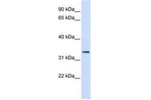 Image no. 1 for anti-F-Box Protein 25 (FBXO25) (AA 36-85) antibody (ABIN6740798)