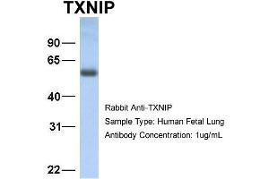 Image no. 3 for anti-Thioredoxin Interacting Protein (TXNIP) (C-Term) antibody (ABIN2784817)