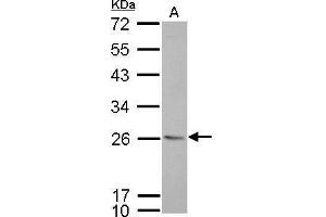 Image no. 3 for anti-HLA-DR-gamma (CD74) (N-Term) antibody (ABIN2856756)