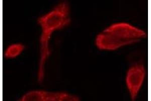 Image no. 1 for anti-Poly(A) Binding Protein, Cytoplasmic 3 (PABPC3) antibody (ABIN6264005)
