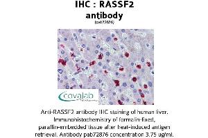 Image no. 2 for anti-Ras Association (RalGDS/AF-6) Domain Family Member 2 (RASSF2) (N-Term) antibody (ABIN1738748)