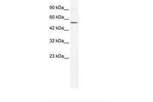 Image no. 1 for anti-Zinc Finger Protein 268A (ZNF286A) (N-Term) antibody (ABIN6735978)