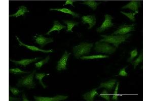 Image no. 3 for anti-Gastric Intrinsic Factor (Vitamin B Synthesis) (GIF) (AA 318-417) antibody (ABIN516031)