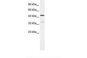 Image no. 1 for anti-Potassium Voltage-Gated Channel, Shaker-Related Subfamily, beta Member 3 (KCNAB3) (AA 81-130) antibody (ABIN202440)