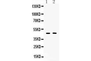 Image no. 3 for anti-serpin Peptidase Inhibitor, Clade A (Alpha-1 Antiproteinase, Antitrypsin), Member 5 (SERPINA5) (AA 86-406) antibody (ABIN5518789)