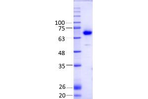 Image no. 2 for Spermine Oxidase (SMOX) (AA 1-555) protein (His tag) (ABIN3077180)